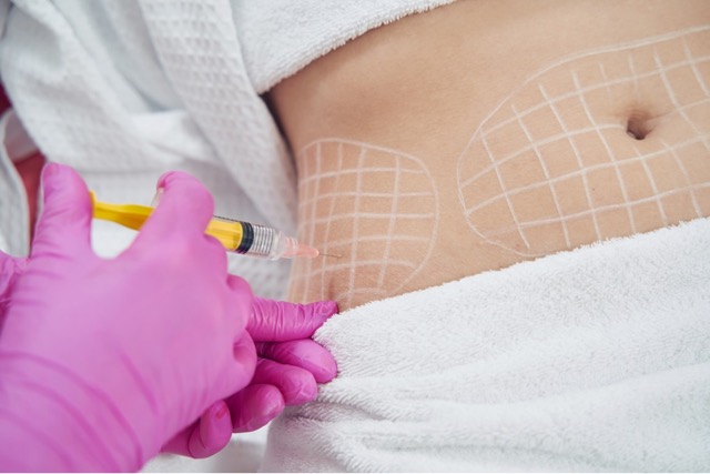 Fat Dissolving Injection London: Transform at Dr. SNA Clinic