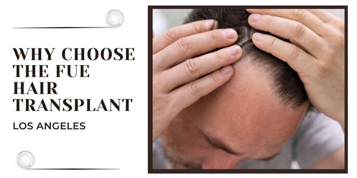 Why Choose the FUE Hair Transplant in Los Angeles?