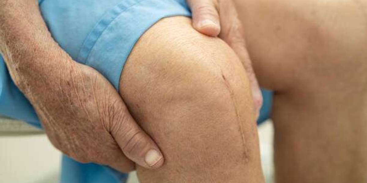 How to Prevent Knee Damage and Delay the Need for Knee Replacement Surgery