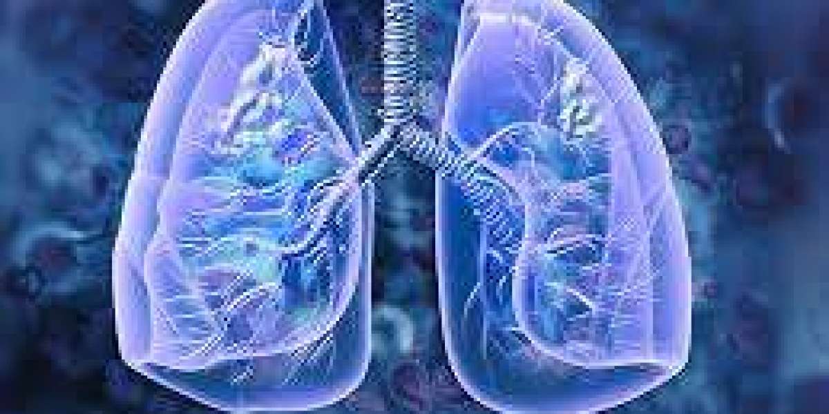 Lung Health Check: Exploring Angiogram and CT Scan Options